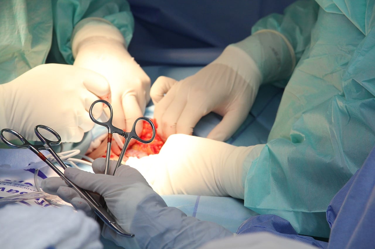 В Рязанской больнице №8 удалили опухоль у 166-килограммовой женщины