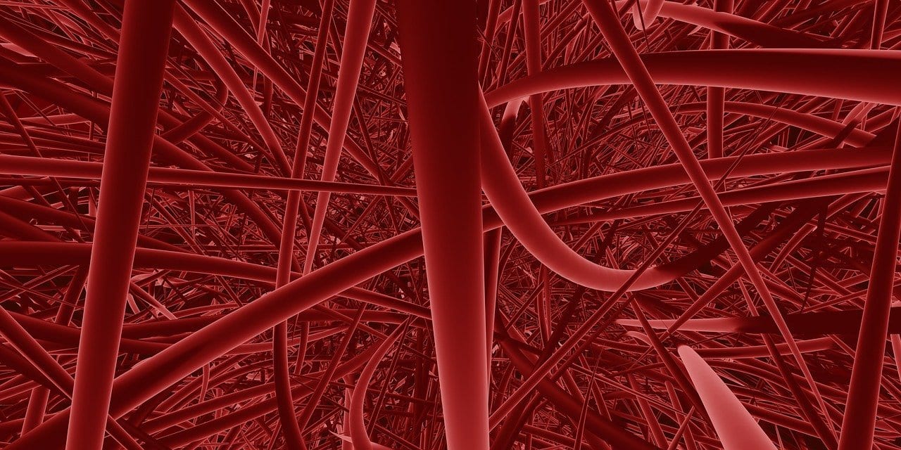 Рязанские учёные разработали 3D –модель, способную диагностировать тромбы и внутренние кровотечения