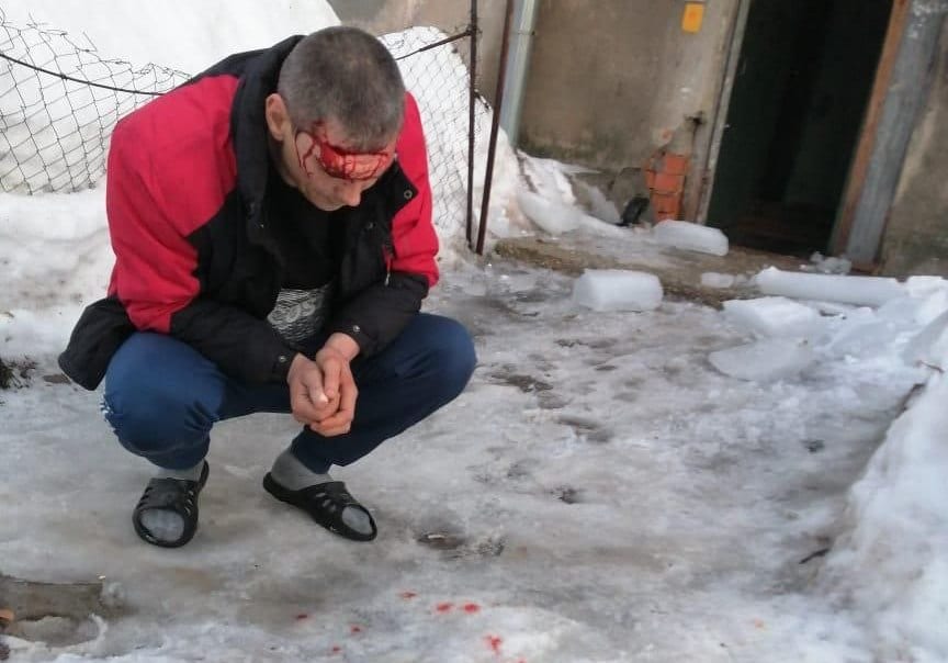 Следователи начали проверку после падения глыбы льда на голову рязанцу