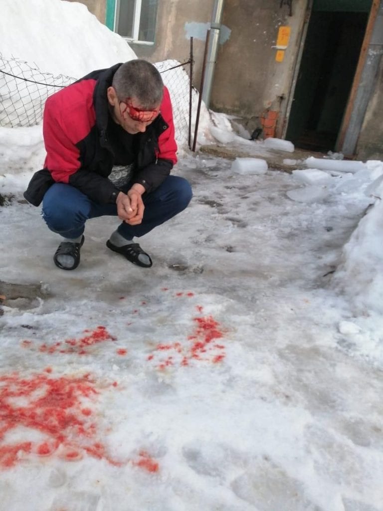 На окраине Рязани упавшая с крыши глыба льда разбила голову мужчине