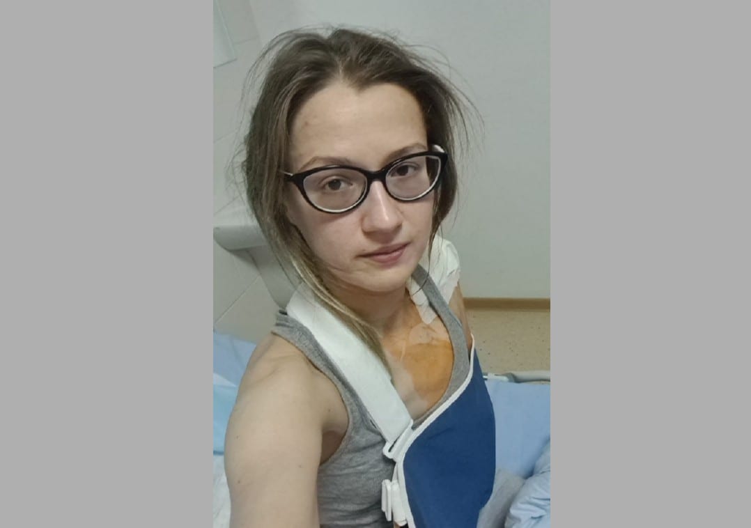 Рязанка Светлана Коновалова, пострадавшая из-за нечищеного перехода, прислала губернатору фото из больницы